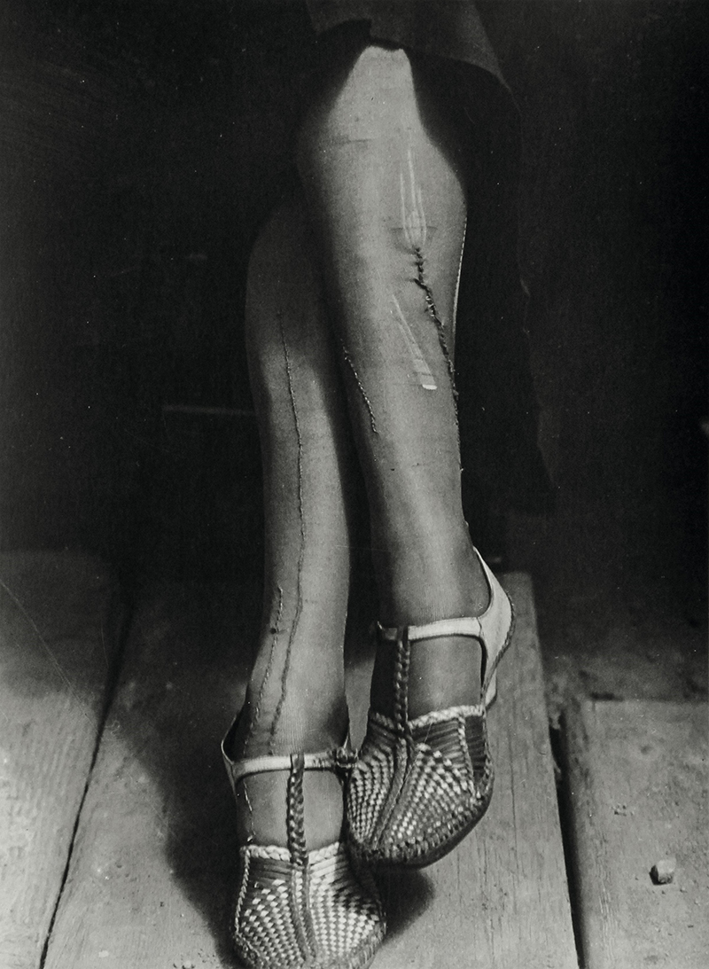 Dorothea Lange , Mended Stockings, San Francisco 1934